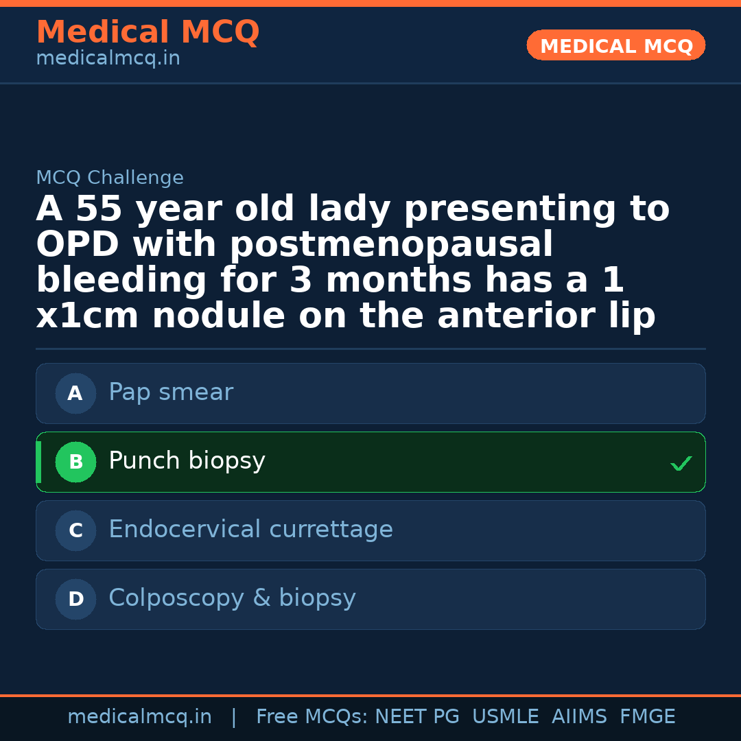 MCQ share card