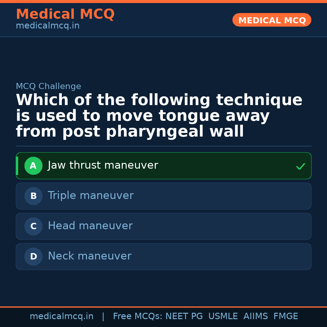 MCQ share card