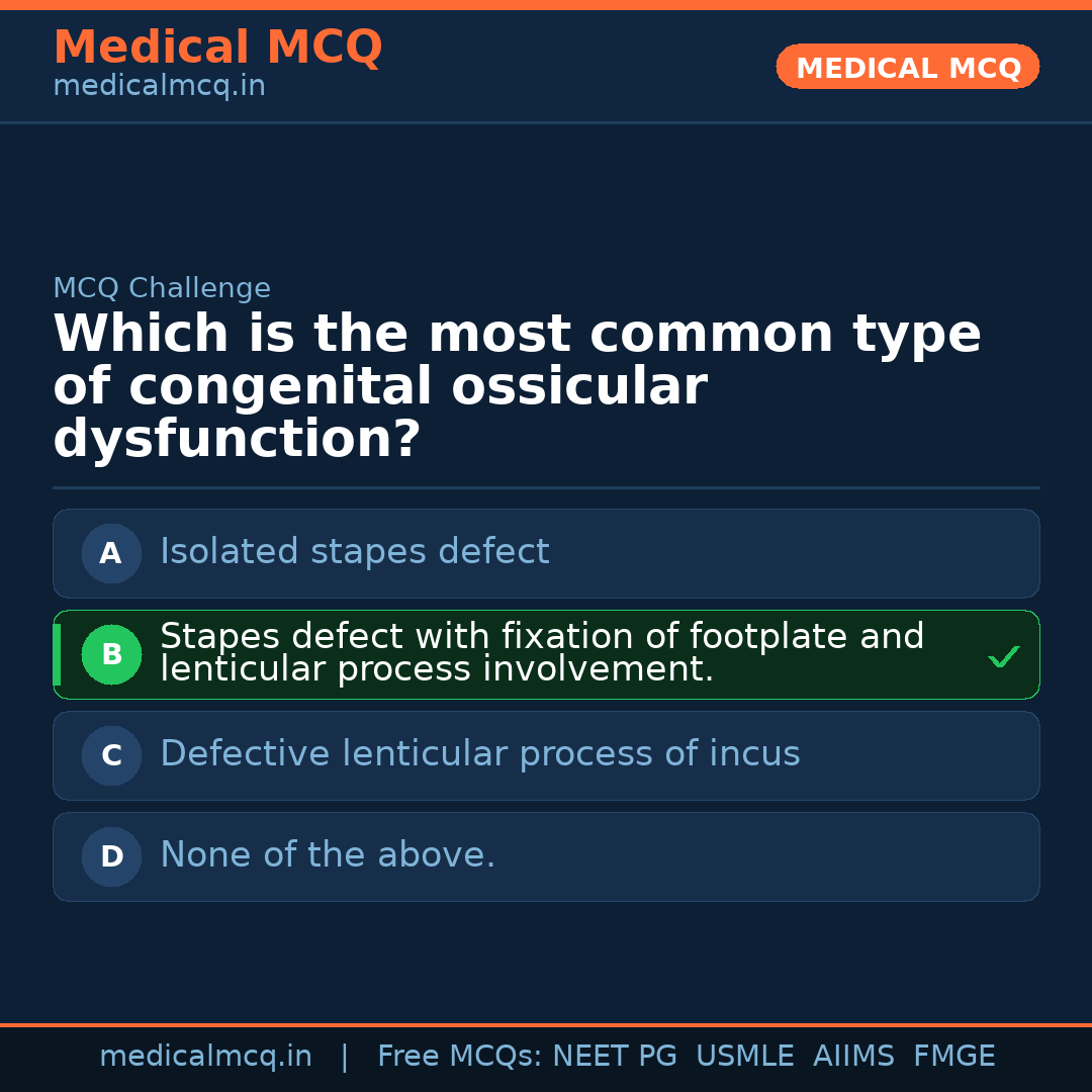 MCQ share card