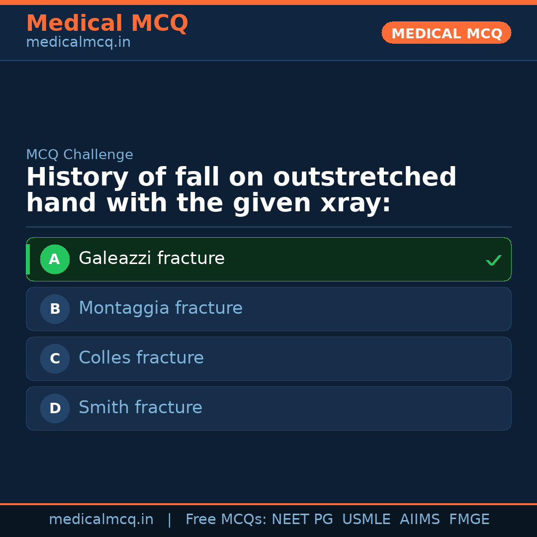 MCQ share card