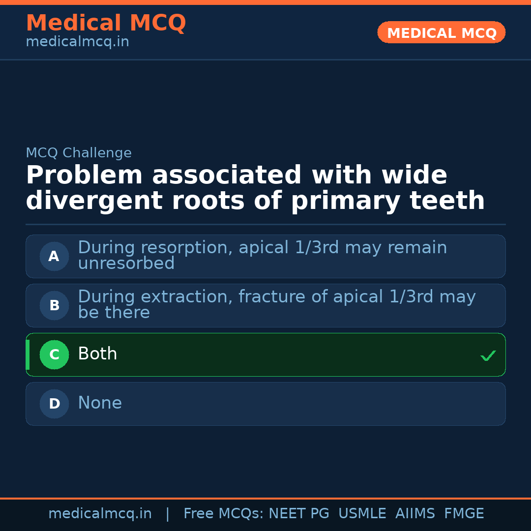 MCQ share card