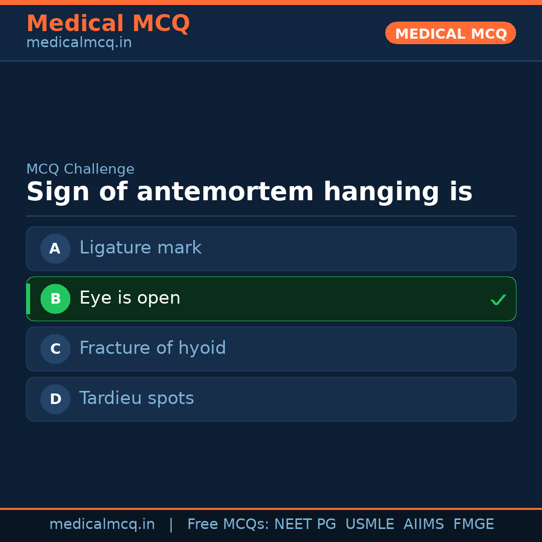 MCQ share card
