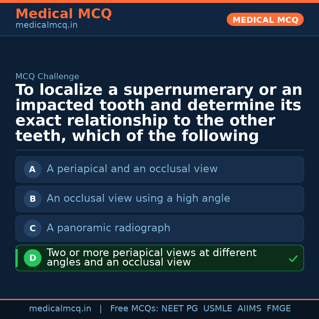MCQ share card