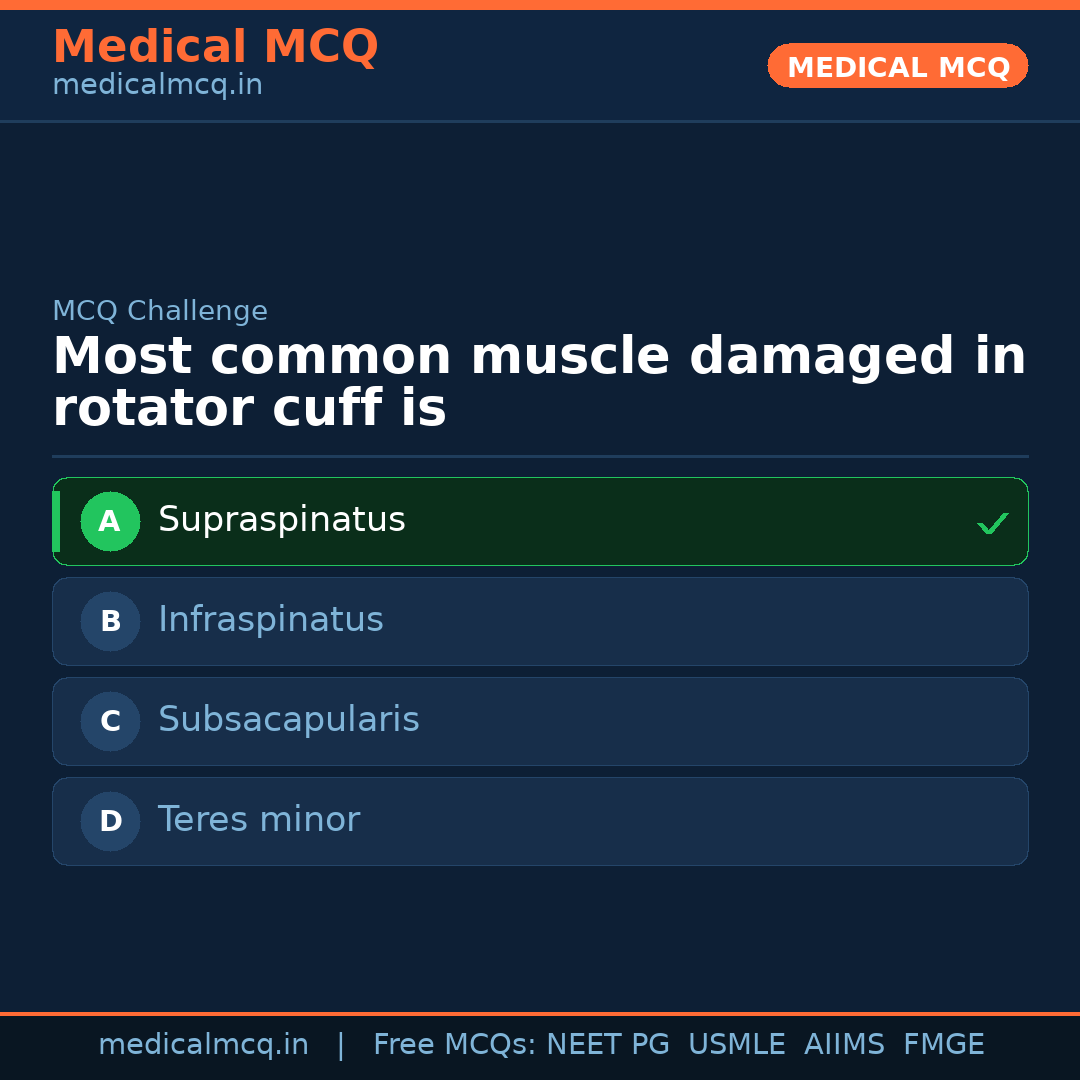 MCQ share card