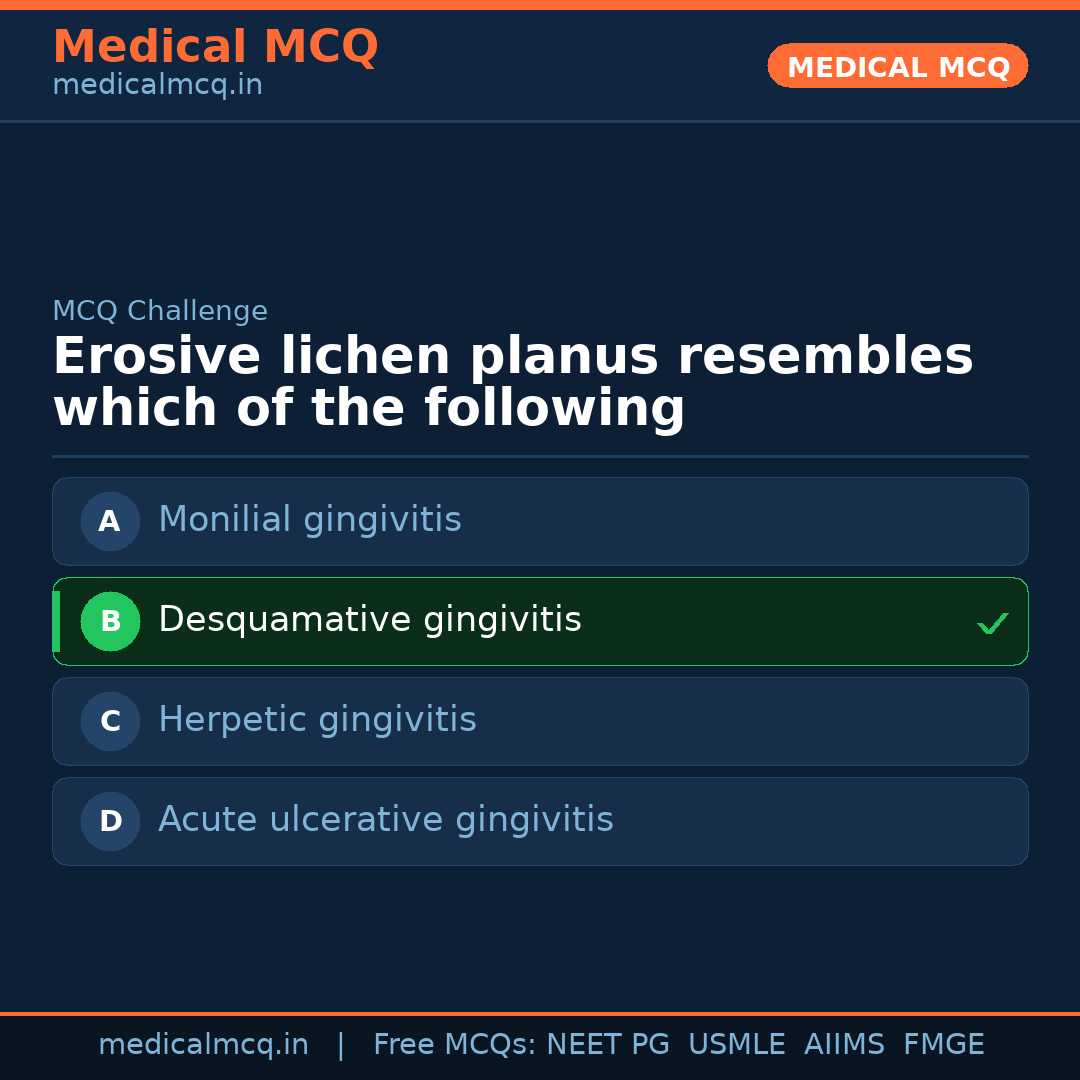 MCQ share card