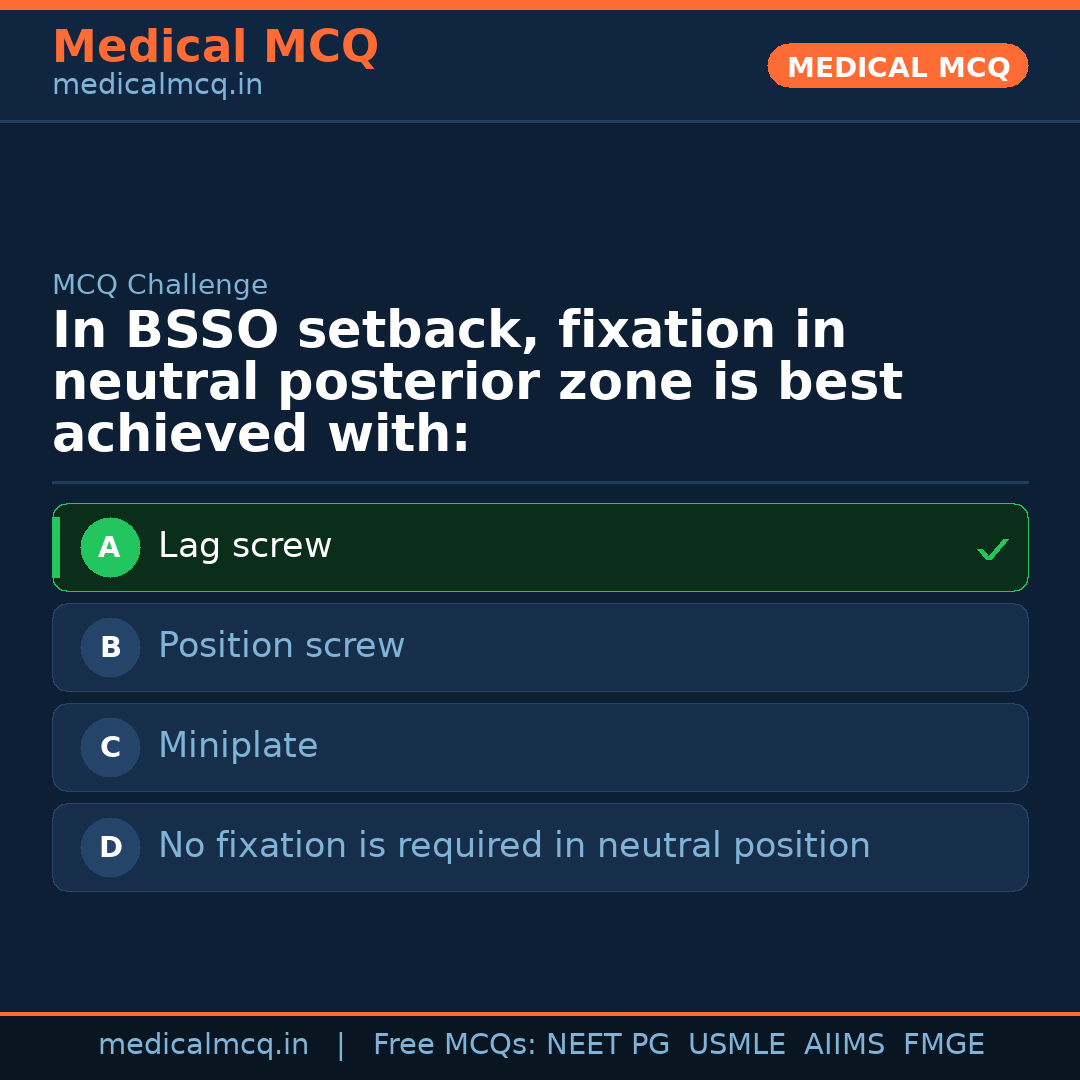MCQ share card
