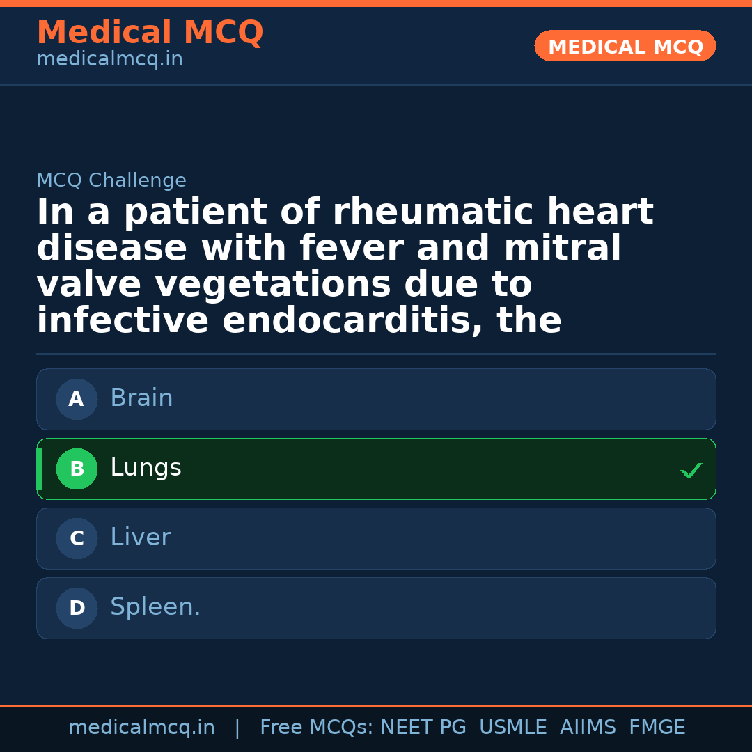 MCQ share card