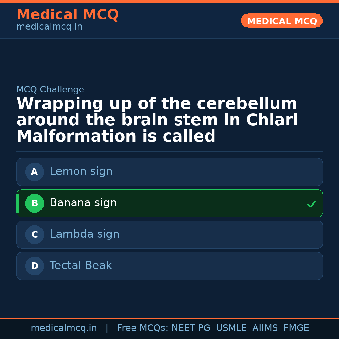 MCQ share card