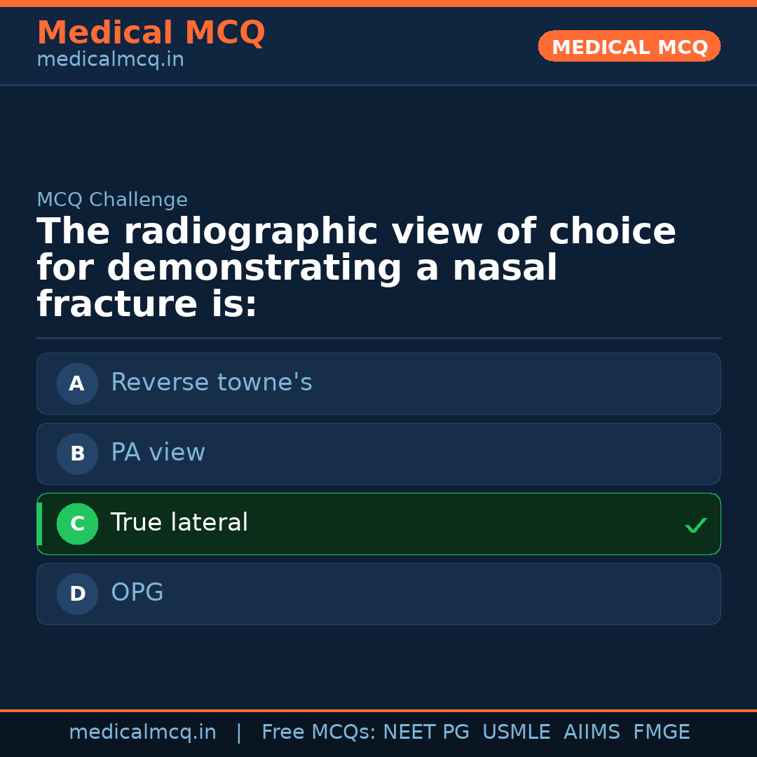 MCQ share card