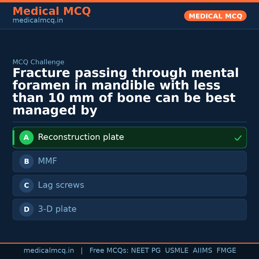 MCQ share card