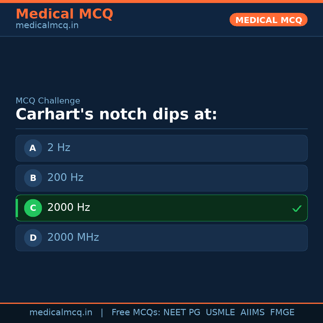 MCQ share card