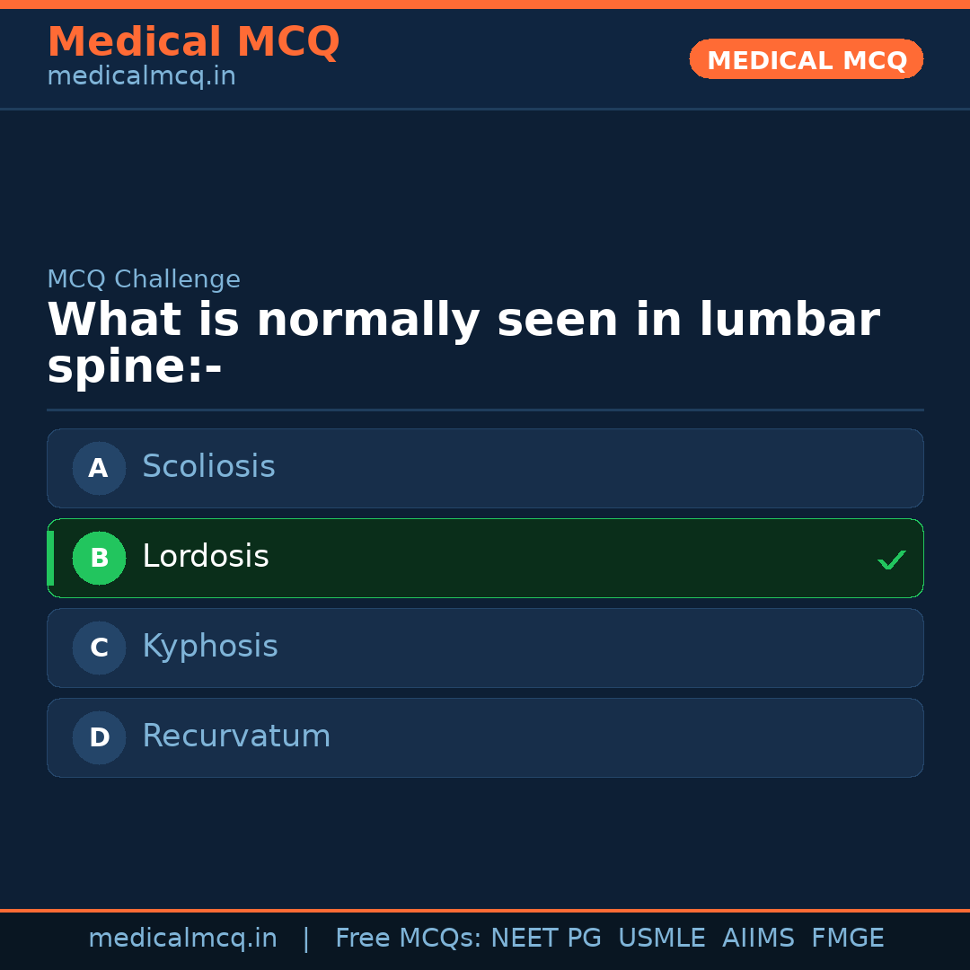 MCQ share card