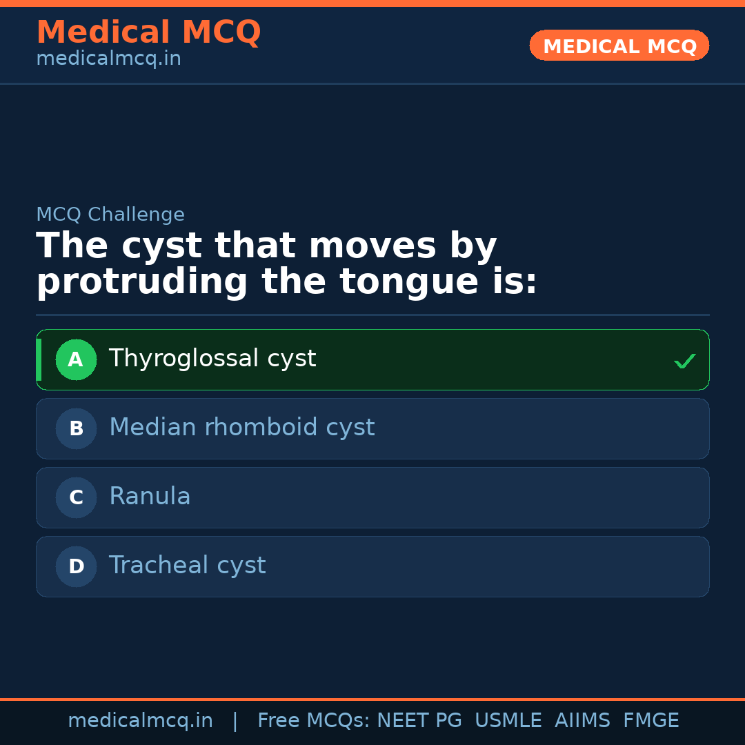 MCQ share card