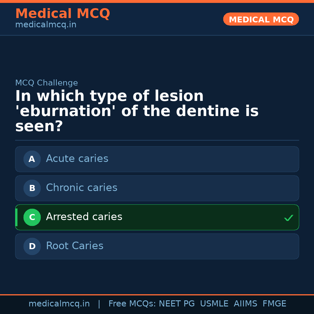 MCQ share card