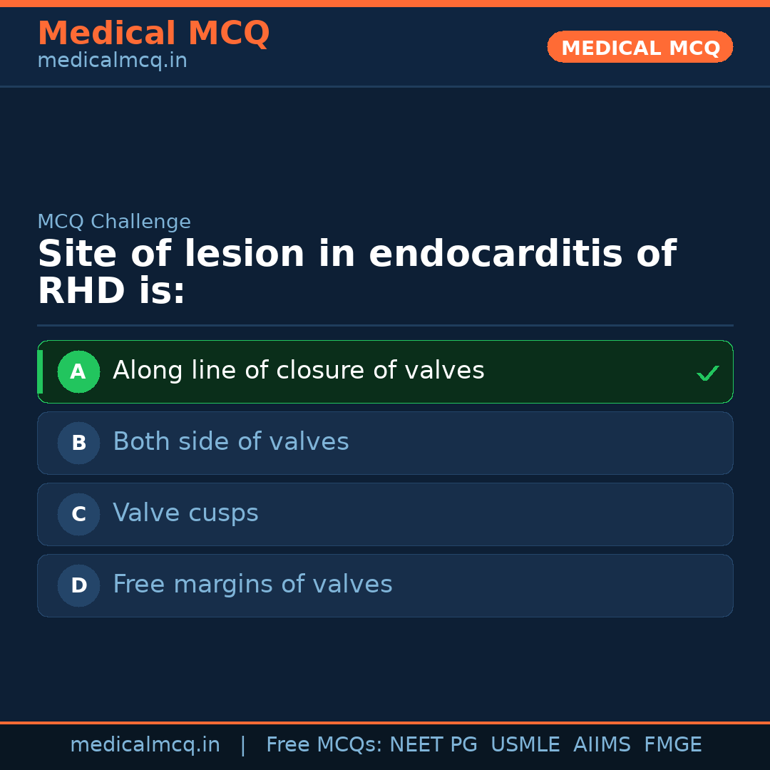 MCQ share card