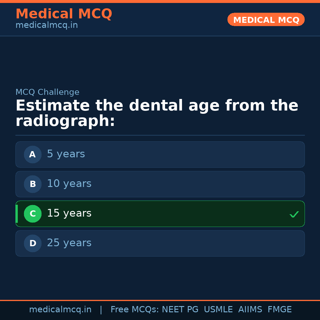 MCQ share card