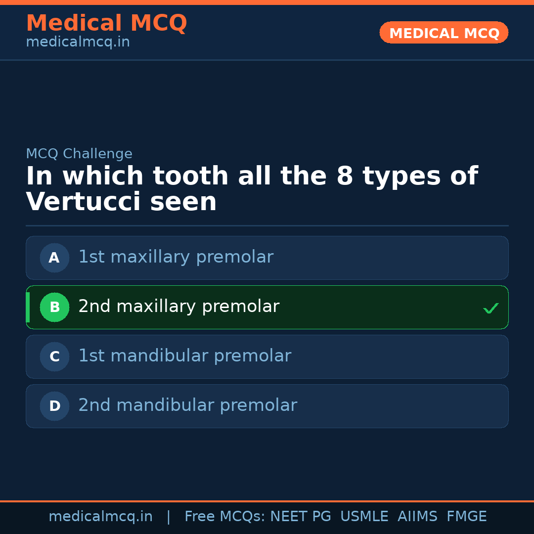 MCQ share card