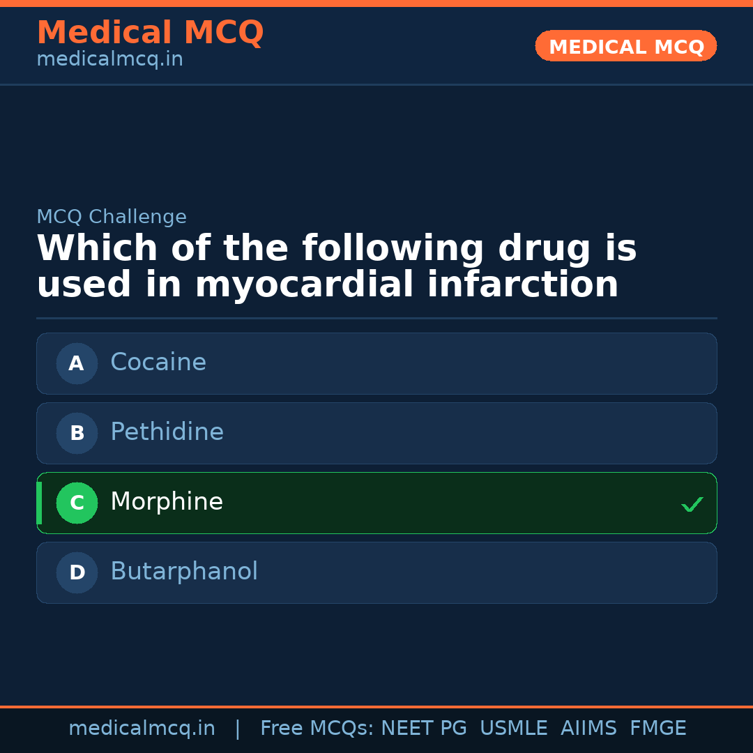 MCQ share card