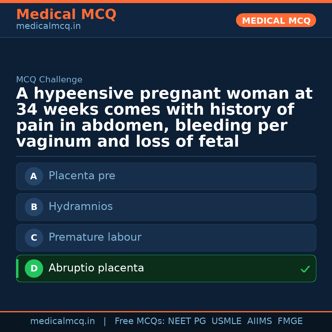 MCQ share card