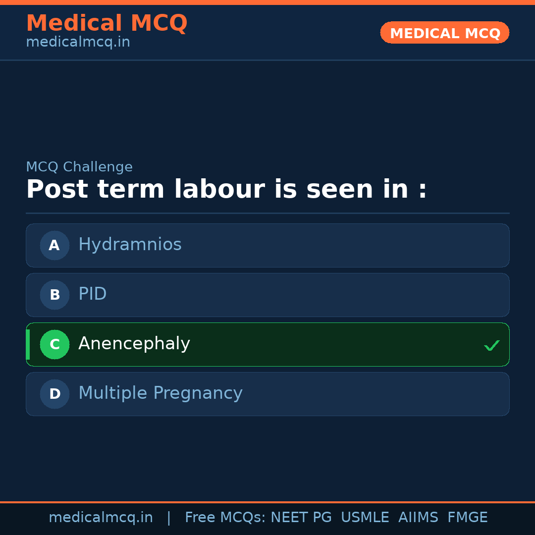 MCQ share card
