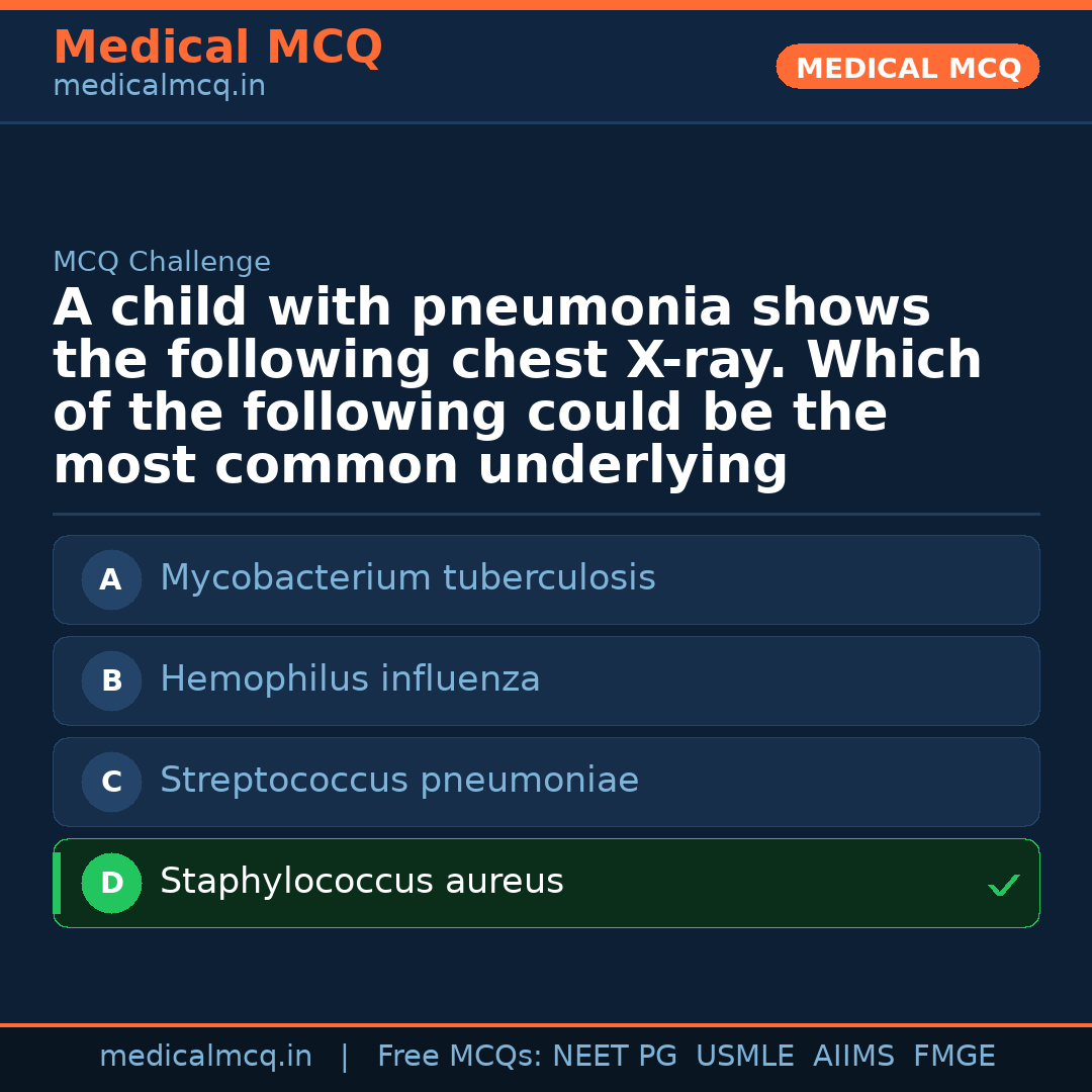MCQ share card