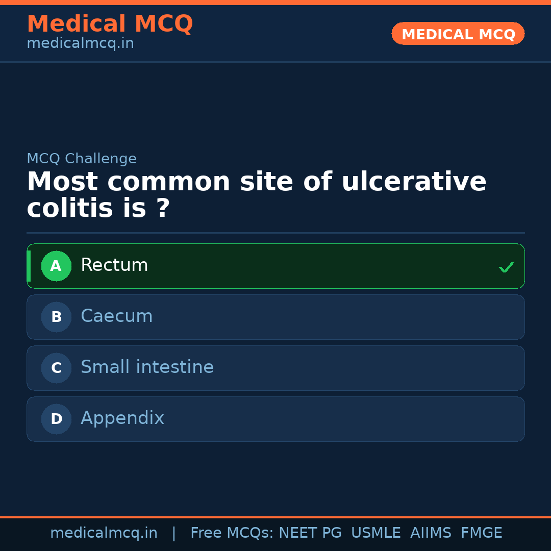 MCQ share card