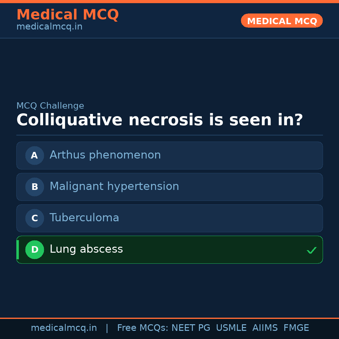 MCQ share card