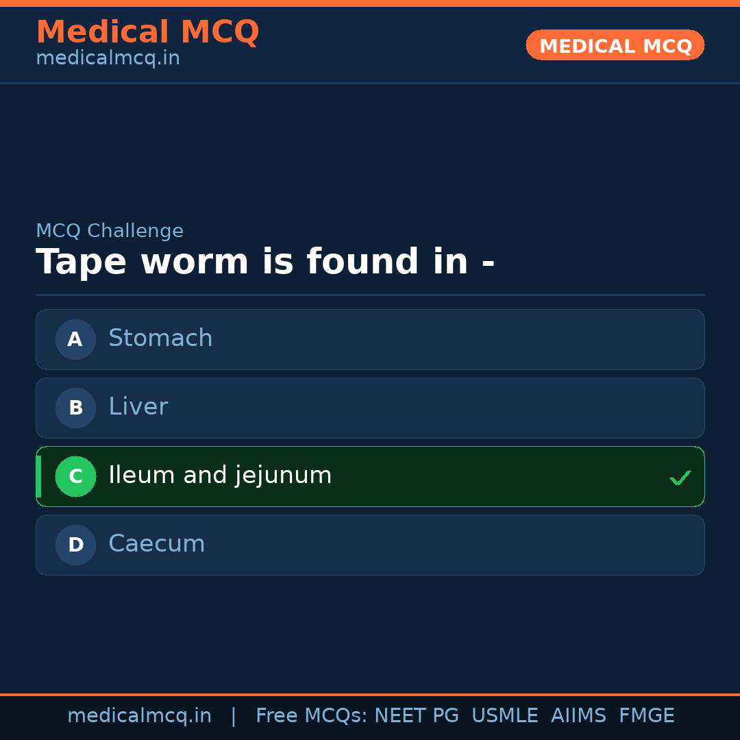 MCQ share card