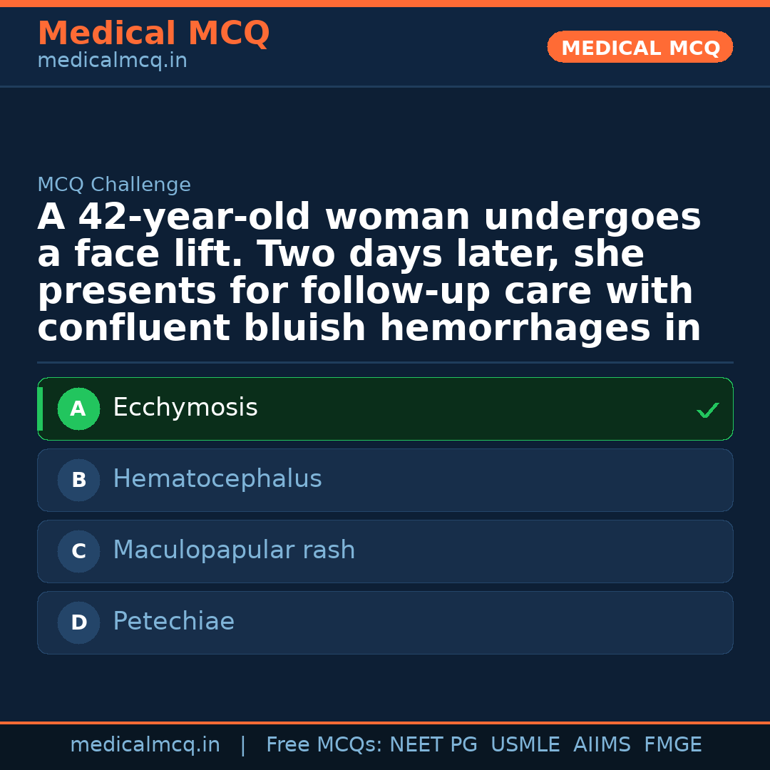 MCQ share card