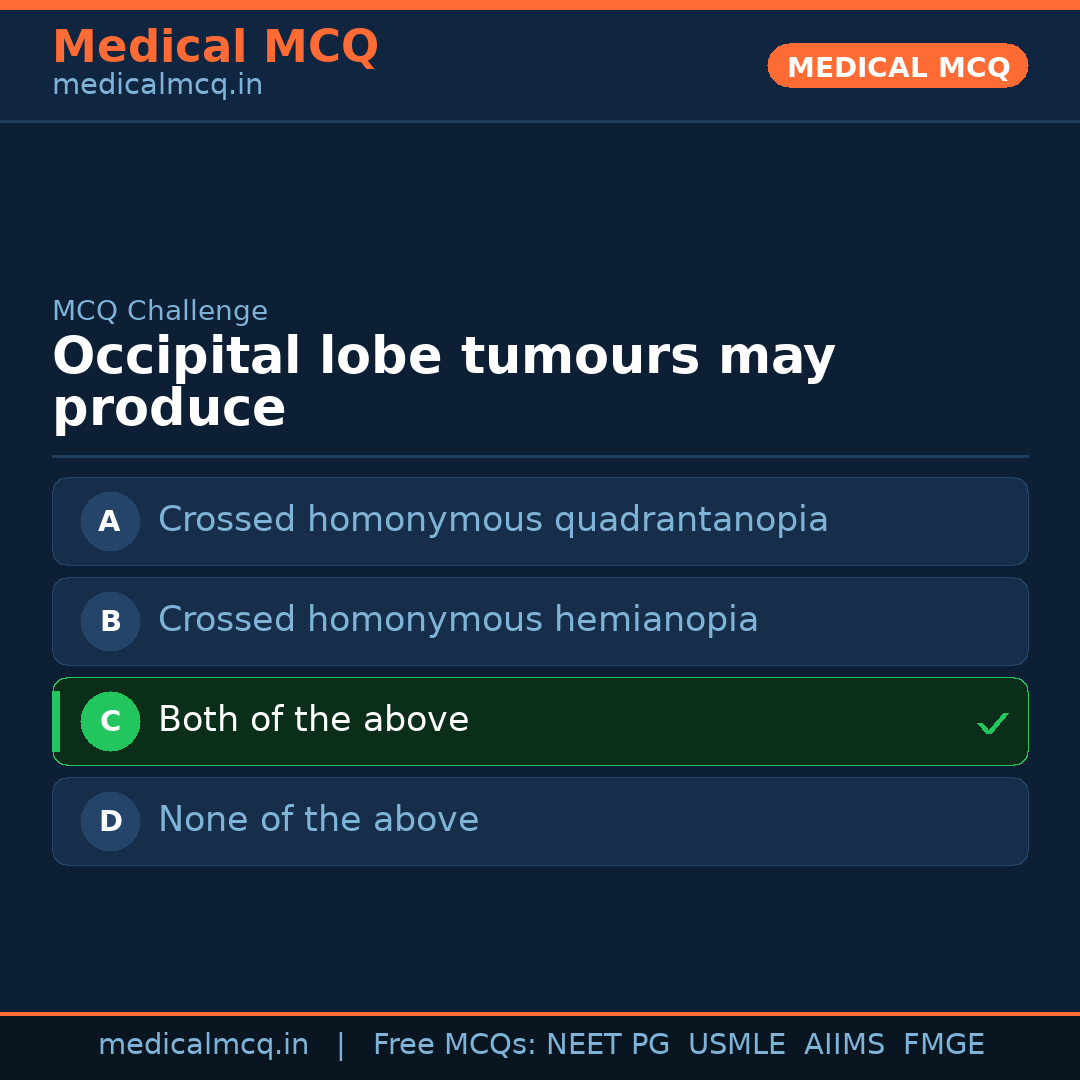 MCQ share card