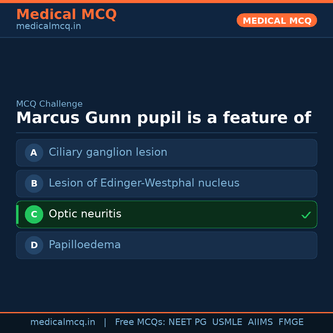 MCQ share card