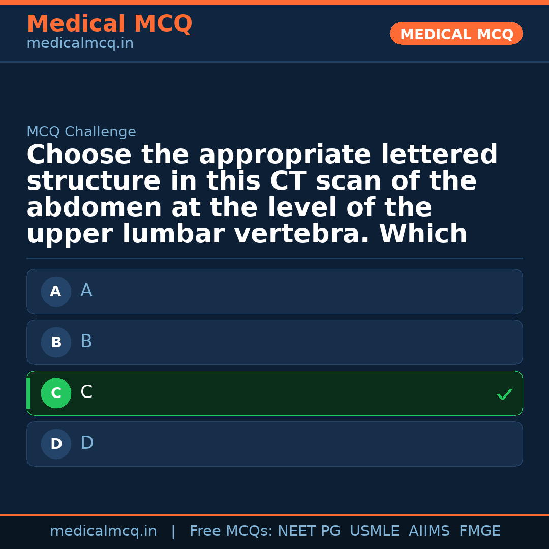 MCQ share card