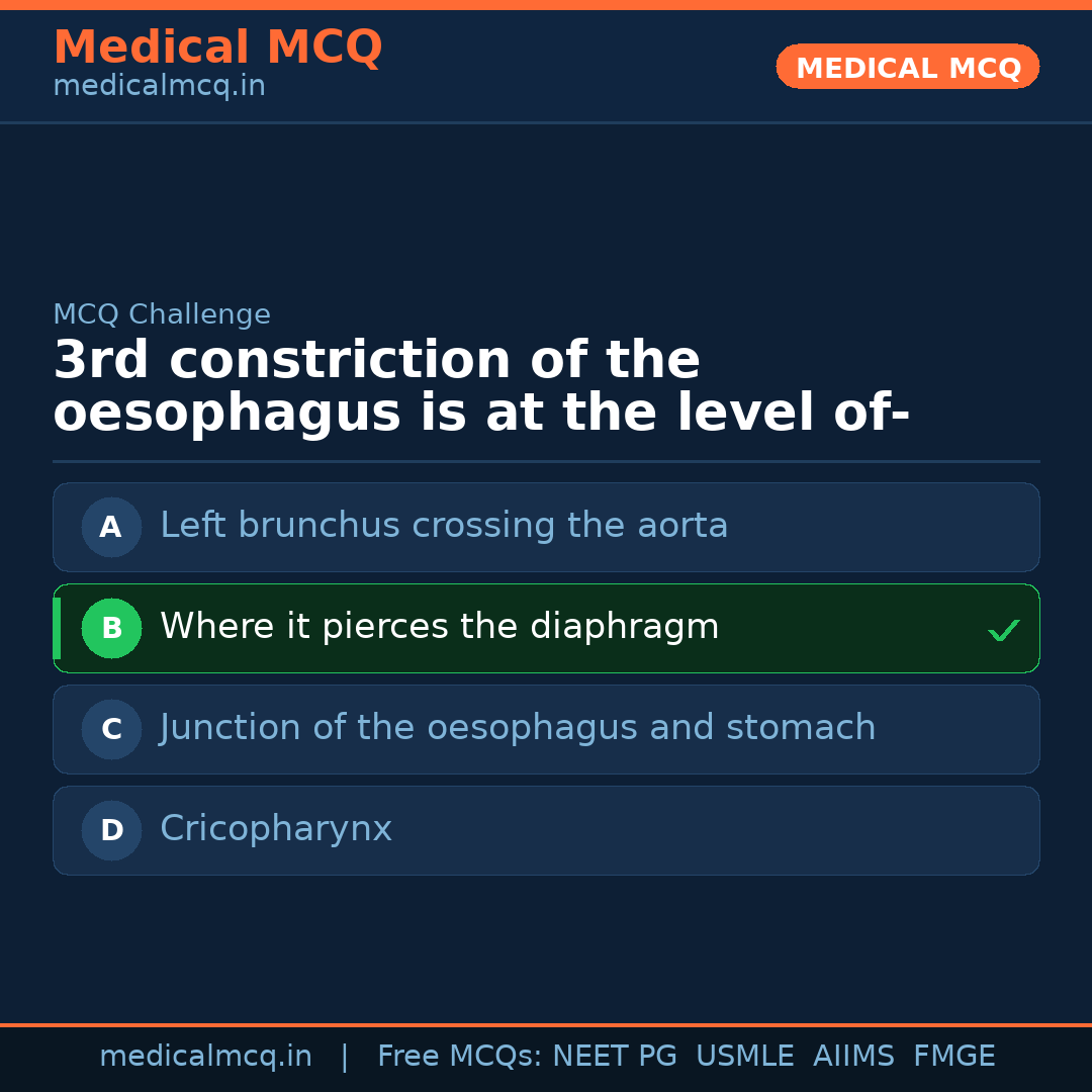 MCQ share card