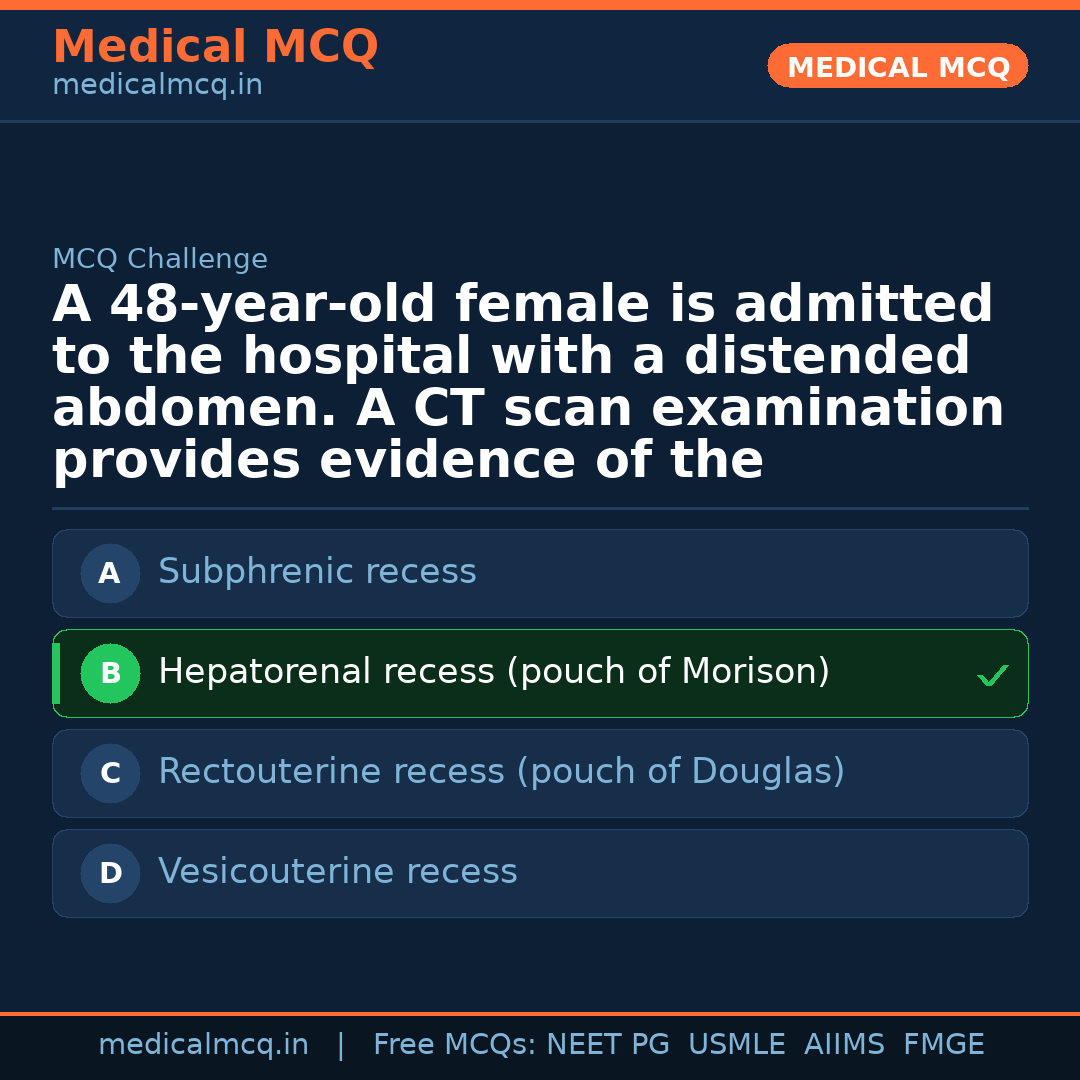 MCQ share card