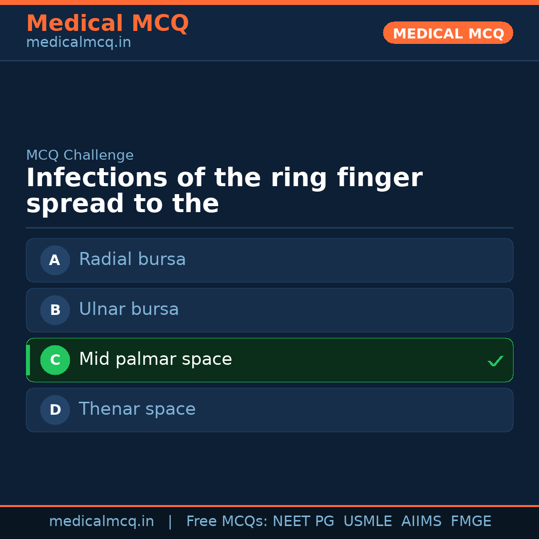 MCQ share card