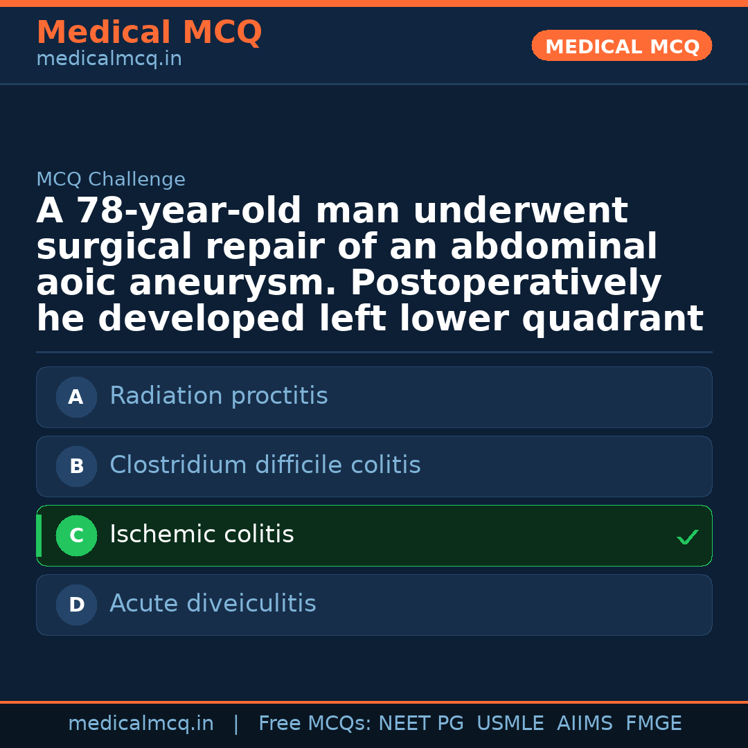 MCQ share card