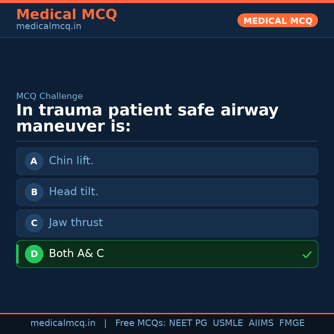 MCQ share card