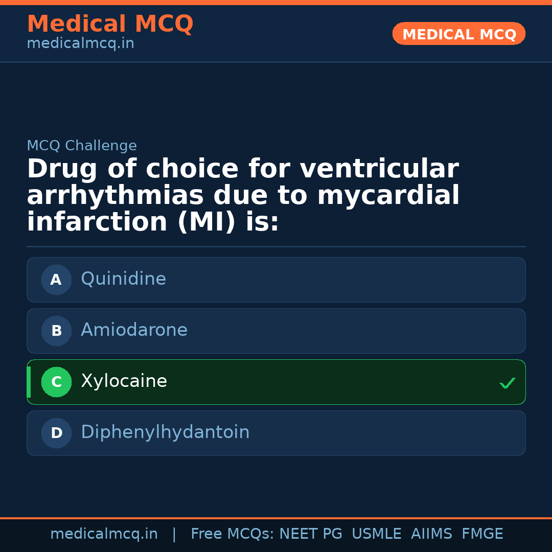 MCQ share card