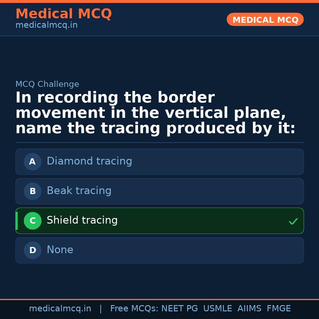 MCQ share card
