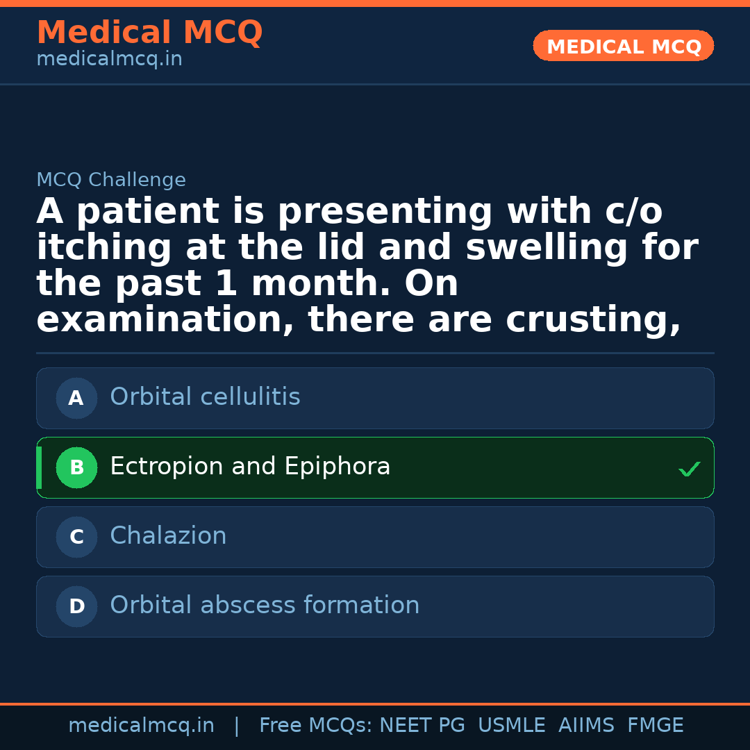 MCQ share card