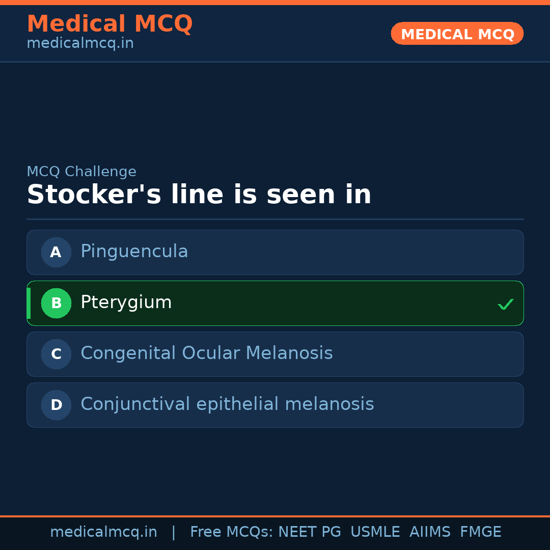 MCQ share card