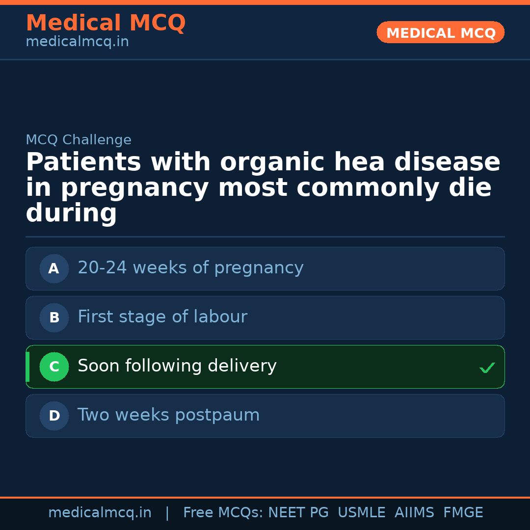 MCQ share card