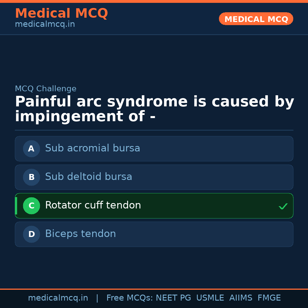 MCQ share card