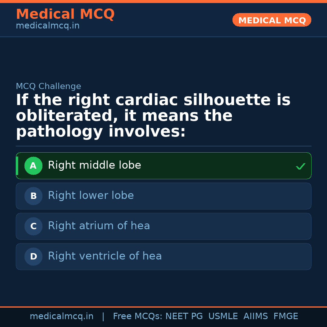 MCQ share card
