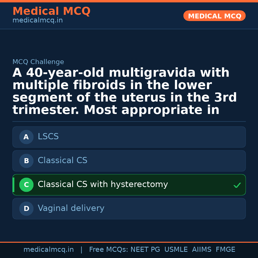 MCQ share card