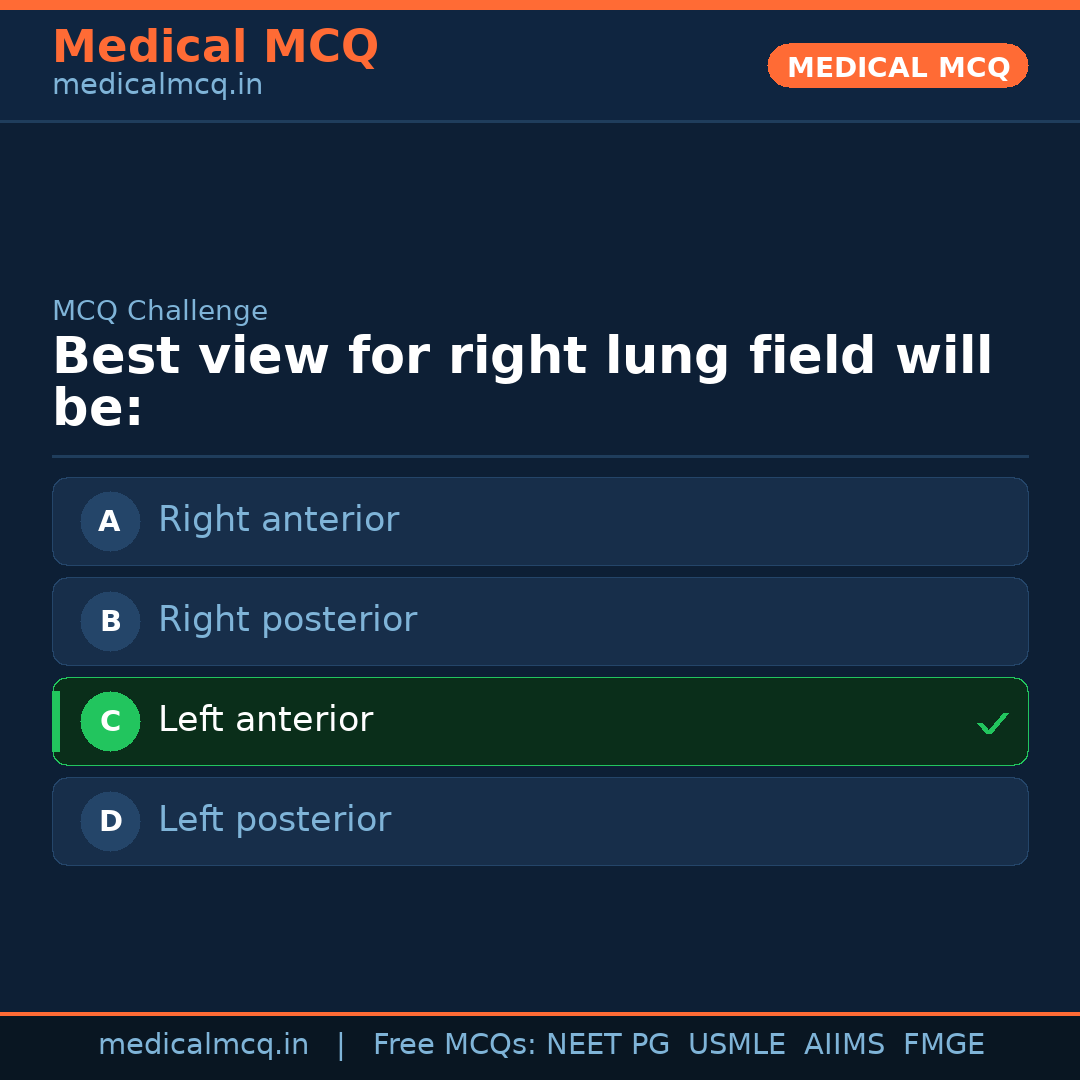 MCQ share card