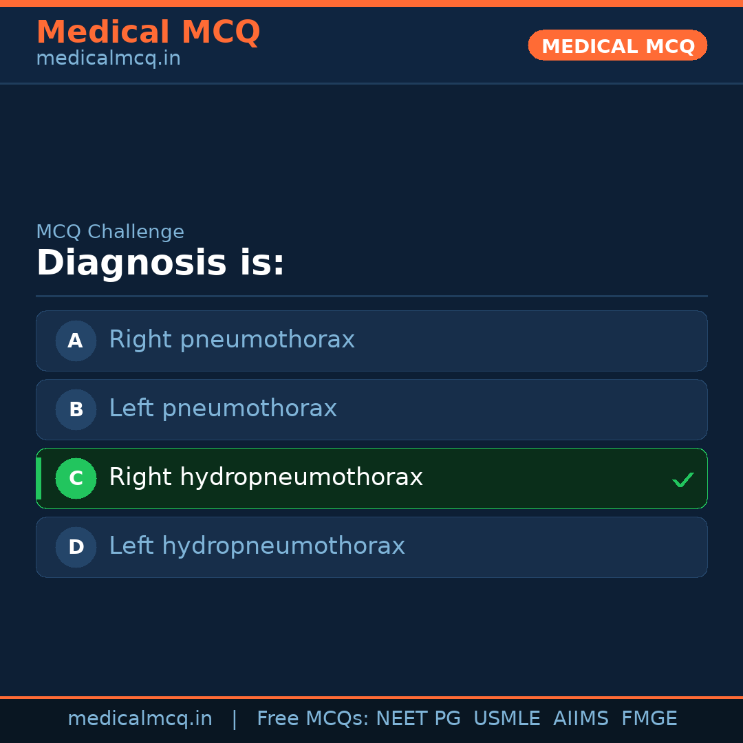MCQ share card