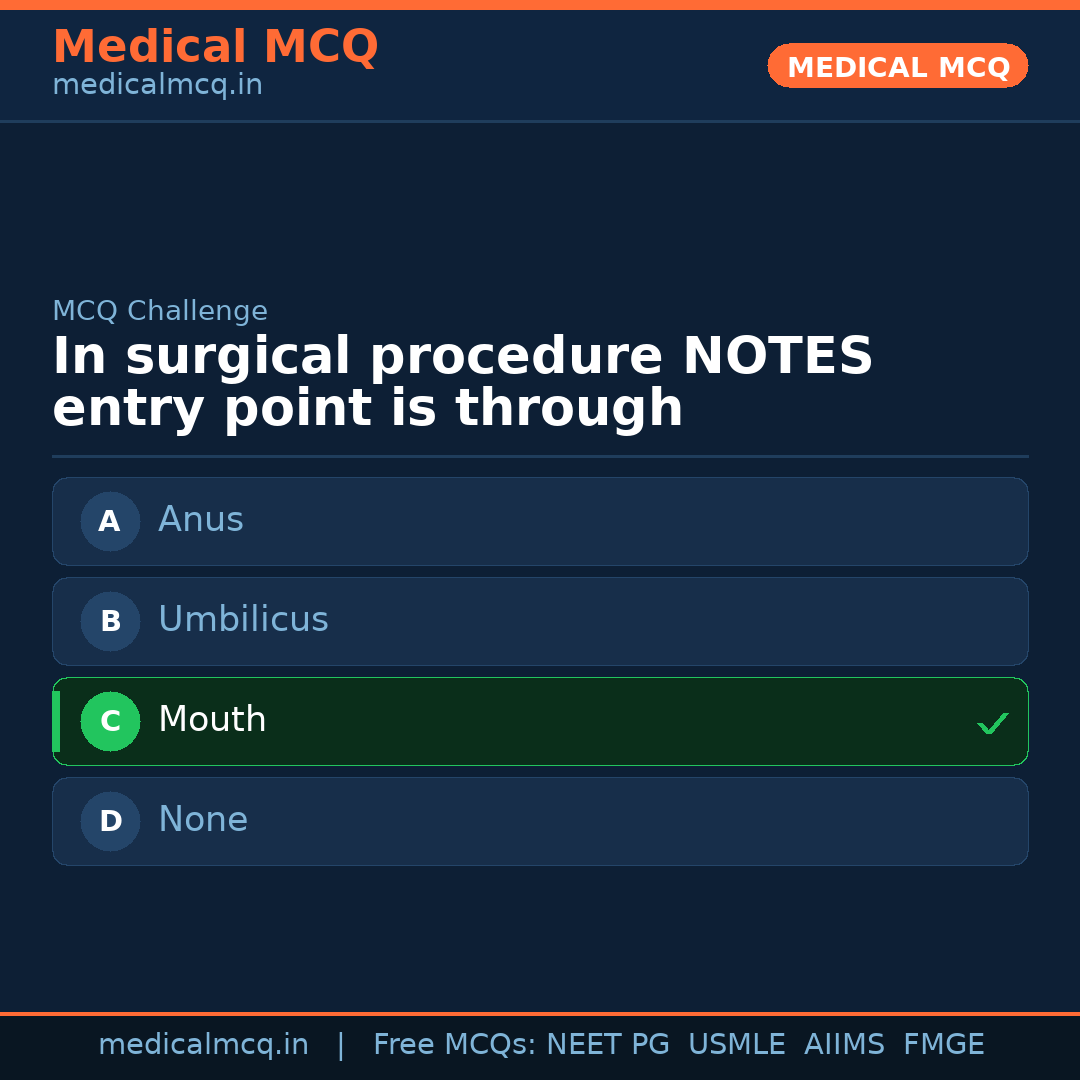 MCQ share card