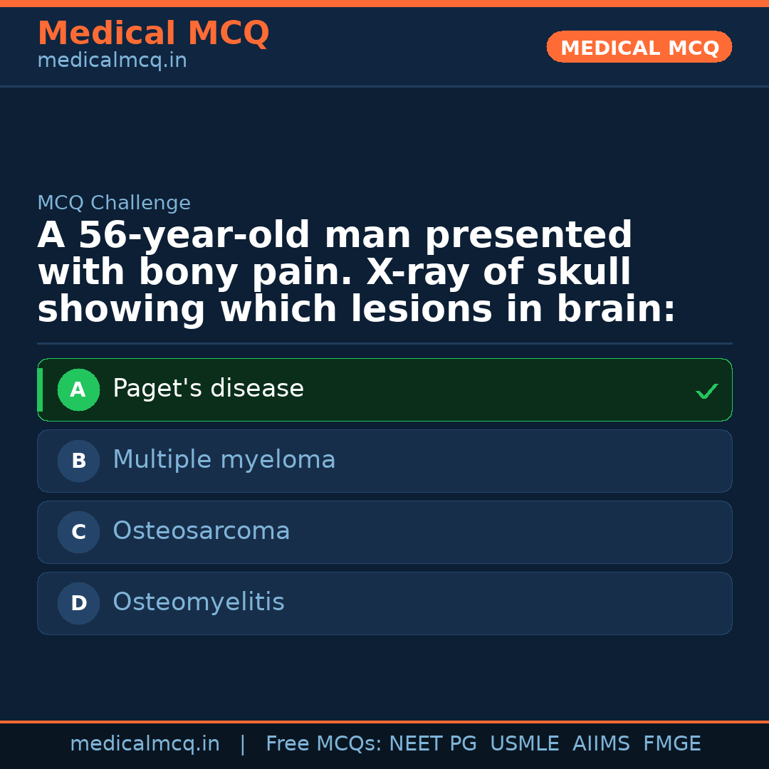 MCQ share card