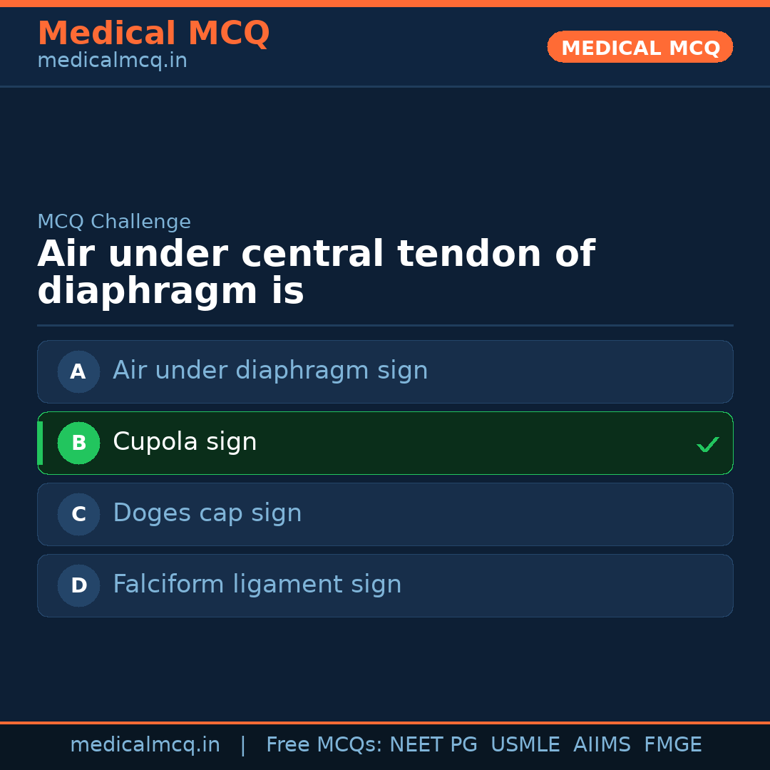 MCQ share card